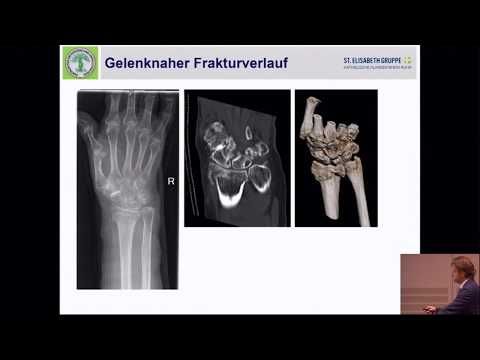 Angeborener Hüftdysplasie Schwindel zervikalen Osteochondrose Tabletten