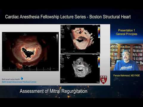 Intraoperative Assessment of Mitral Regurgitation