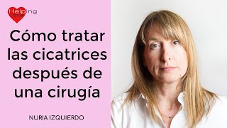 Cómo tratar las cicatrices después de una cirugía o reconstrucción de la mama.