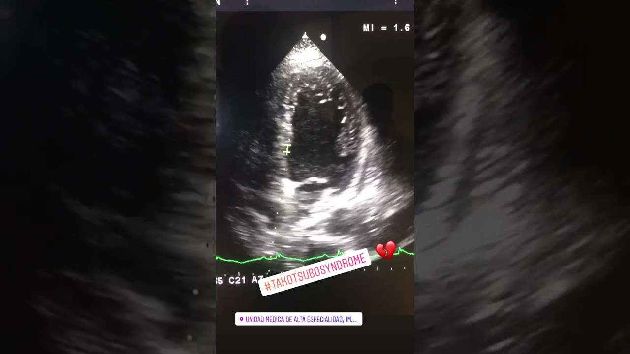 Gonzalo Gutierrez Vasquez-16