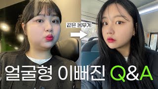 턱살부자에서 턱살거지 된 썰ㅣ 성형브이로그 2편ㅣ뷰티라인성형외과