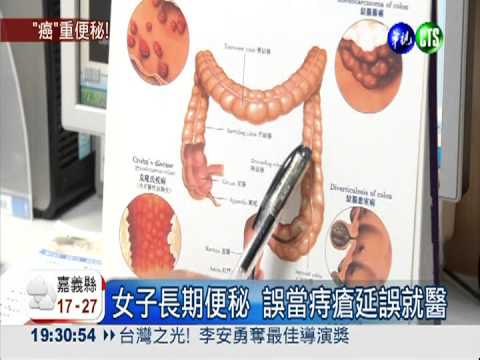 女子便秘當痔瘡 罹大腸癌渾不知