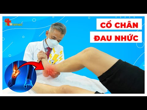 Cổ Chân Đau Nhói Như Xé Mỗi Bước Đi? Đã Đến Lúc Bạn Chấm Dứt Nó Hoàn Toàn!