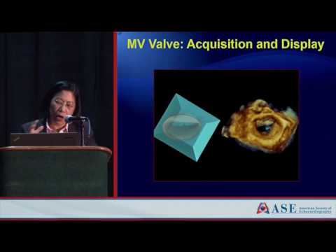 Advances in 4D TEE Imaging by Rebecca Hahn