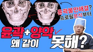 양악 윤곽 왜 같이 못해? 같이해도 돼 괜찮아 얼굴프로필 분석 제대로하면.