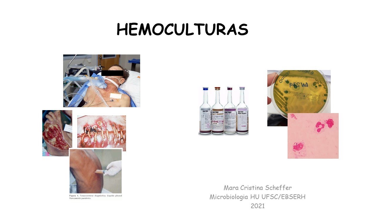 Coleta de Hemocultura