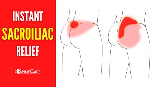 How to Fix Your Sacroiliac Joint Pain | STEP-BY-STEP Guide