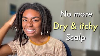 STARTER LOC JOURNEY TIPS- How To Get Rid of Dry, Itchy Scalp