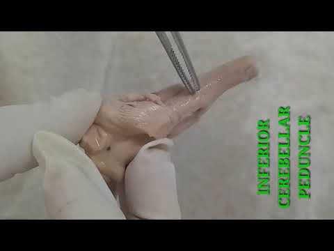 NEUROANATOMY - MEDULLA OBLONGATA EXTERNAL FEATURES - BY DR MITESH DAVE