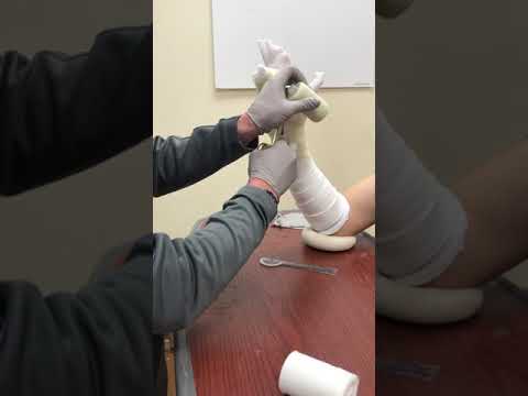 How to apply an Ulnar Gutter Cast