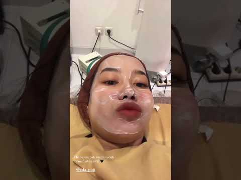 Elvara caliva baju putih mantul cantik 1
