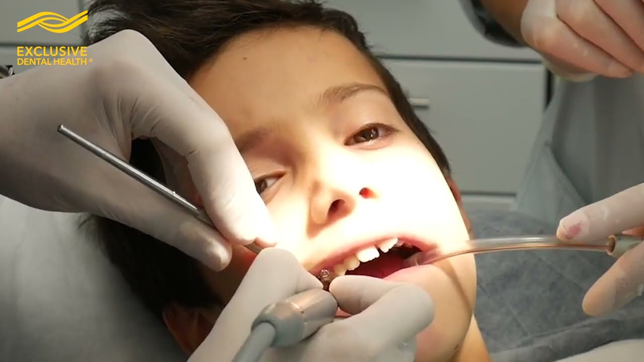 LA SOLUZIONE PER CURARE LE CARIE DI CHI HA PAURA DELL'ANESTESIA