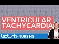 Ventricular Tachycardia: ECG Interpretation & Presentation