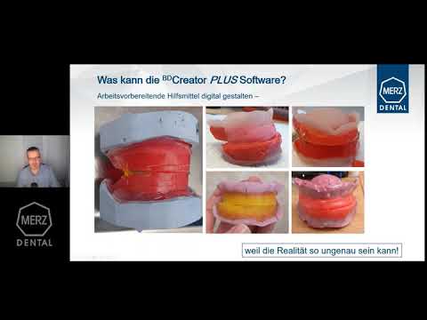 Webinar: Baltic Denture System Teil 3 - Konstruktion | #BalticDentureSystem