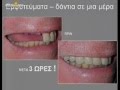video thumbnail (2)