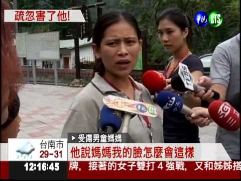 廢工寮玩火紋身! 9歲童3度灼傷