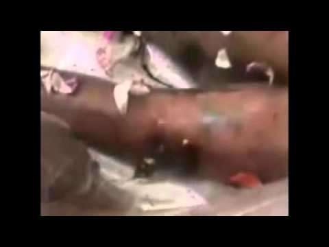 جثمان الطفل (حمزة علي الخطيب) في بلدة الجيزة بمحافظة درعا الذي تعرض للاعتقال من قبل قوات الأمن أثناء مشاركته بمظاهرات "جمعة الغضب" الذي كان يظهر على جثمانه آثار التعذيب الوحشي