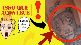 Foi passar óleo de girassol, a tatuagem ficou cheia de bolinhas igual a espinhas