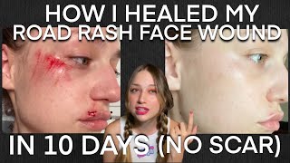 How to Stop Your Wound from Scarring (my facial road rash quick healing experience with no scar)