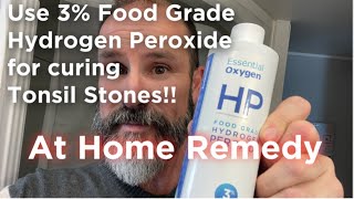3% Food Grade Hydrogen Peroxide - BEST AT HOME CURES FOR TONSIL STONES !!!!