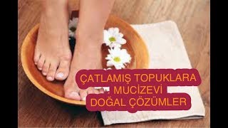 TOPUK ÇATLAKLARI İÇİN MUCİZEVİ DOĞAL ÇÖZÜMLER