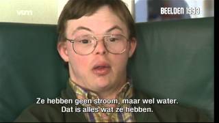 Jambers - Syndroom van Down