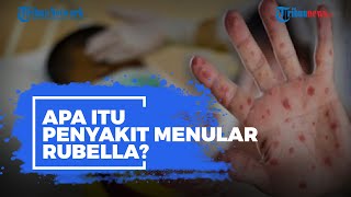 Apa Itu Penyakit Menular Rubella?