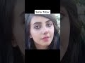 Extreme Plastic Surgery Fails