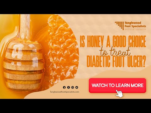 Is Honey a Good Choice to Treat a Diabetic Foot Ulcer?
