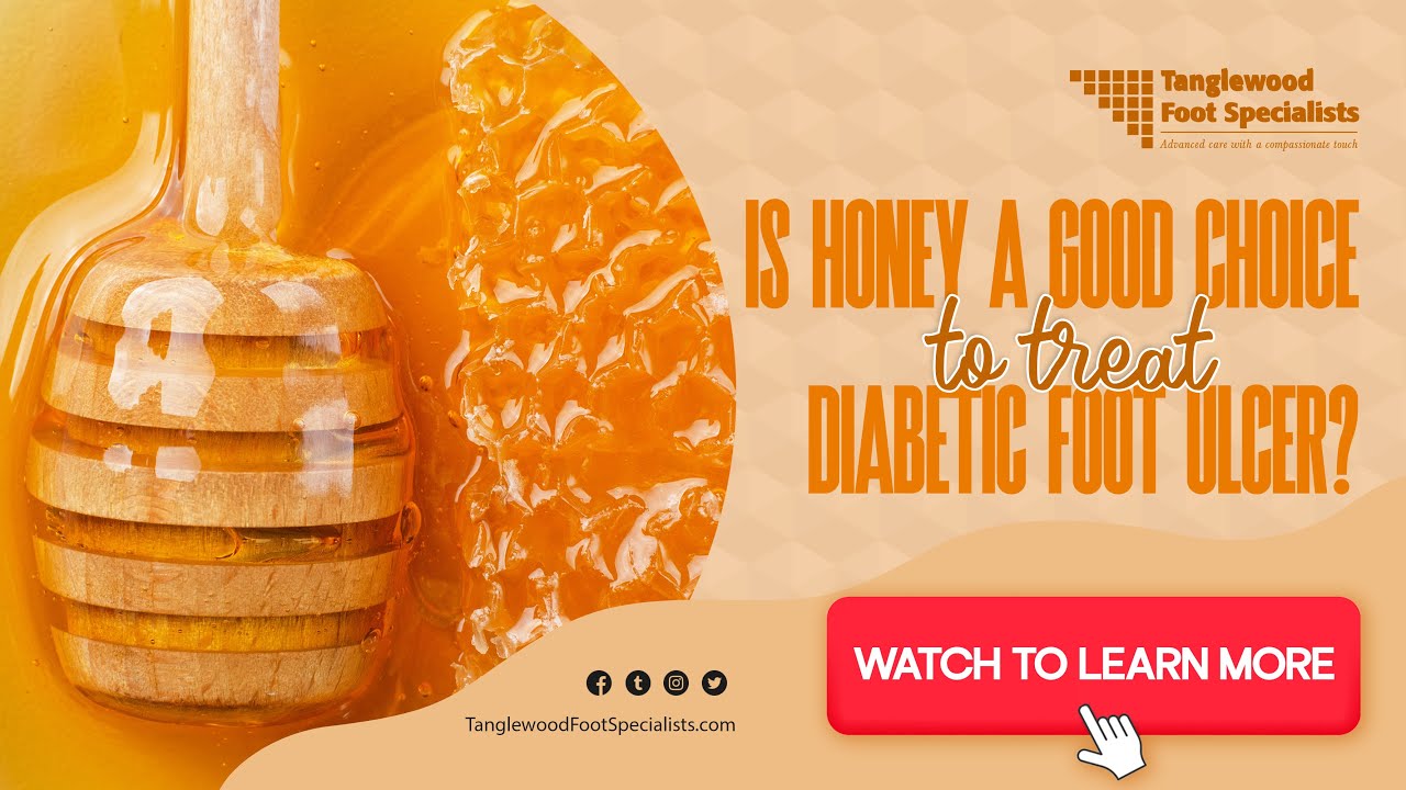 Is Honey a Good Choice to Treat a Diabetic Foot Ulcer?
