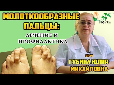 Молоткообразные пальцы. Индивидуальные ортопедические стельки. Рассказывает Губина Юлия Михайловна.