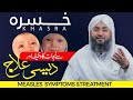 Khasra Ki Bimari Ka Khas Wazifa Measles Symptoms Treatment Khasra خسرہ Ka Desi Ilaj