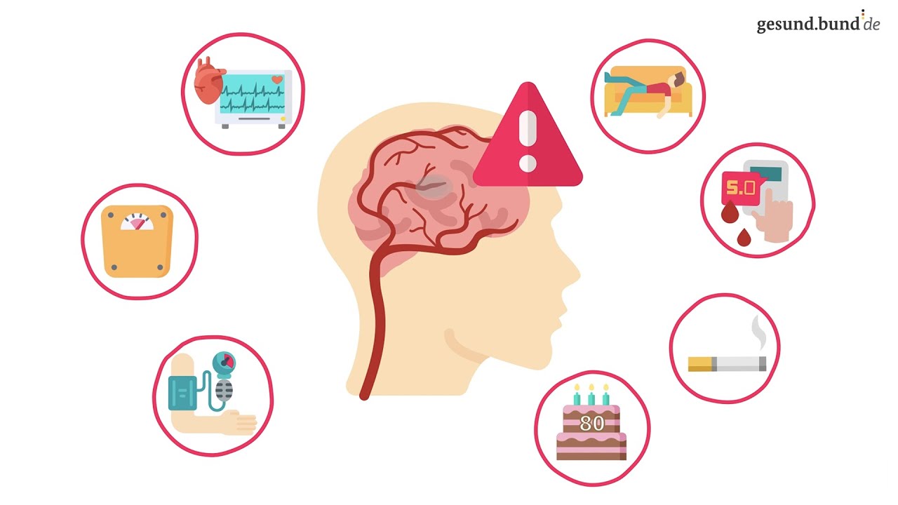 Was passiert bei einem Schlaganfall?