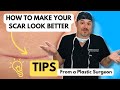 Tips for Treating Scars