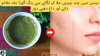 Besan face pack for clear skin | Face pack for pimple and acne | Gram flour for skin whitening