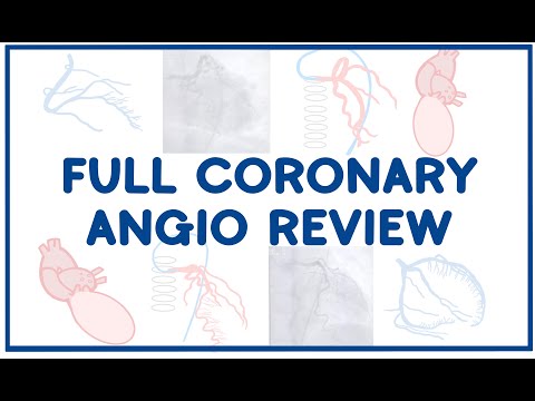 Vollständiger Überblick über die Angiogramm-Anatomie!