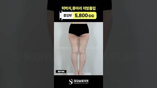 이건 살 뺀 게 아니고 조각임