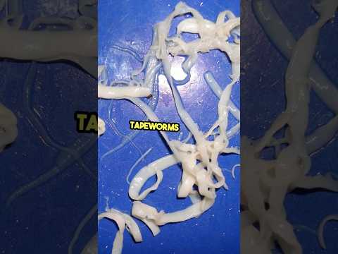 what the sign of tapeworm attack? #tapeworm #parasite