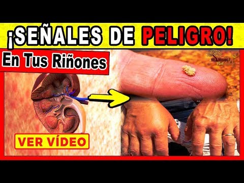 download lagu mp3 mp4 Como Saber Si Tus Riones Funcionan Bien, download lagu Como Saber Si Tus Riones Funcionan Bien gratis, unduh video klip Como Saber Si Tus Riones Funcionan Bien