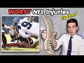 Worst NFL Injuries EVER Doctor Explains Johnny Knox BROKEN SPINE Career Ending