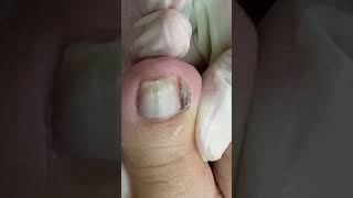 Download lagu #satisfying #nails #satisfyingvideo #shortsvideo #short mp3 Download lagu #satisfying #nails #satisfyingvideo #shortsvideo #short mp3