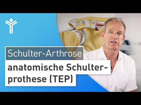Joint replacement for shoulder arthrosis: The anatomical shoulder prosthesis (TEP)