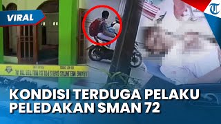 Konidisi Terduga Pelaku Peledakan SMAN 72 Jakarta, Dirawat di Ruang ICU hingga Didampingi Psikolog