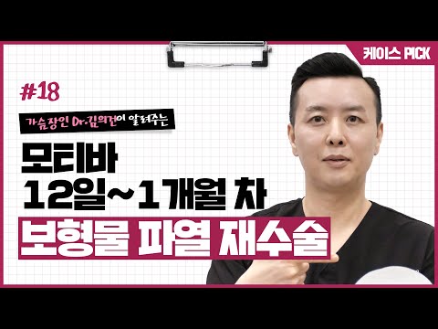 가슴 재수술 케이스 리뷰 I 10년전 가슴수술, 재수술 가능할까? I 보형물 파열 I 가슴골 벌어짐 I 찌그러진 모양 | 윈느성형외과 라벨윈느 유튜브 영상
