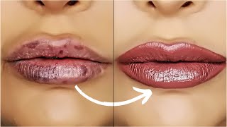 Lip Injections MESSED ME UP! | How To Cover Bruising from Lip Filler
