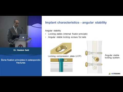 INTRAMEDULLARY NAILING IN OSTEOPOROTIC BONES