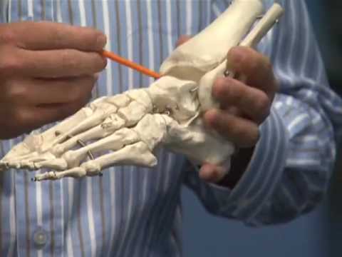 Gonarthrose des Knies dass sie ein Verfahren der Behandlung ist, Aufnahmen von Osteoarthritis des Knies m