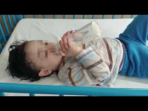 Premieră medicală, realizată de prof. Marcel Tanțău, în Cluj. Pacientul: un copilaș de 2 ani