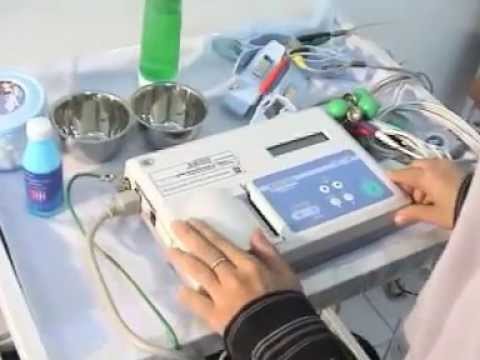 download video viral Cara Menghitung Rr Ekg, download Cara Menghitung Rr Ekg gratis, unduh Cara Menghitung Rr Ekg