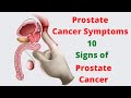 Prostate Cancer Symptoms – 10 Signs of Prostate Cancer